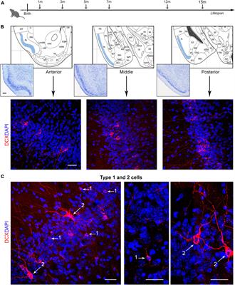 Age-related changes in layer II immature neurons of the murine piriform cortex